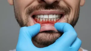 gum disease
