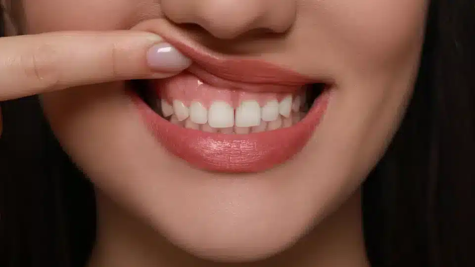 gum recession treatment
