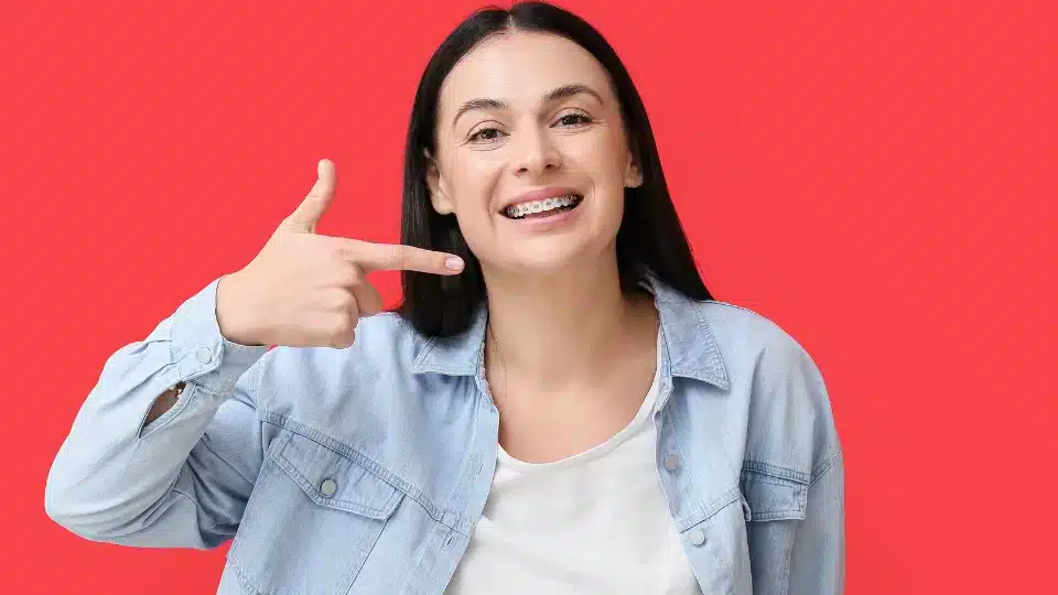 how are braces put on