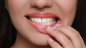 periodontal disease