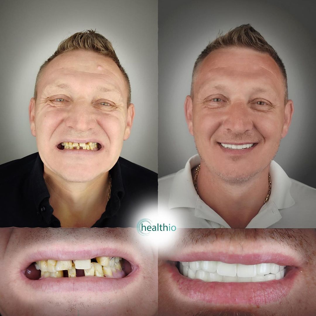 Snapinsta.app_448889490_17913662741958558_2050588628032545923_n_1080