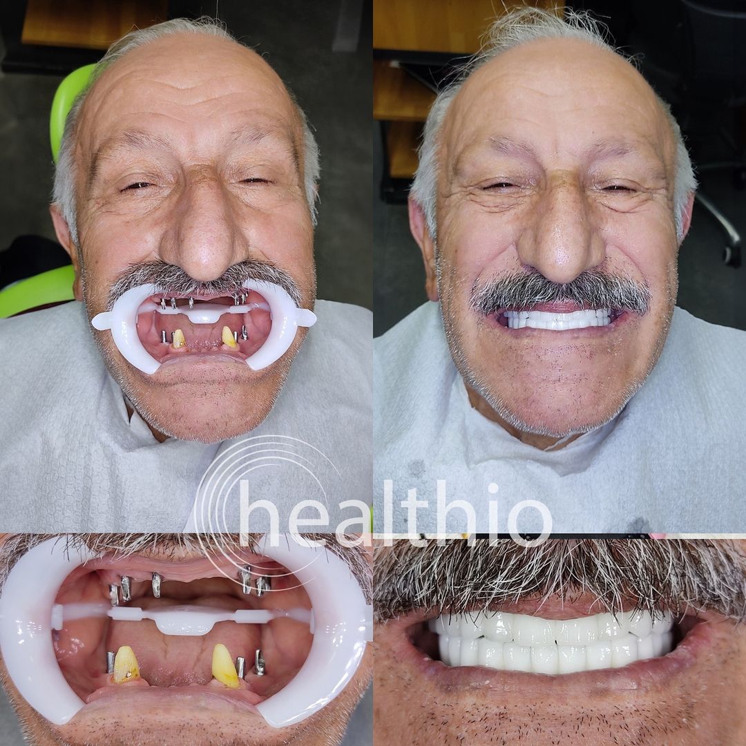 Snapinsta.app_457131235_833556545582748_7586075425063179611_n_1080