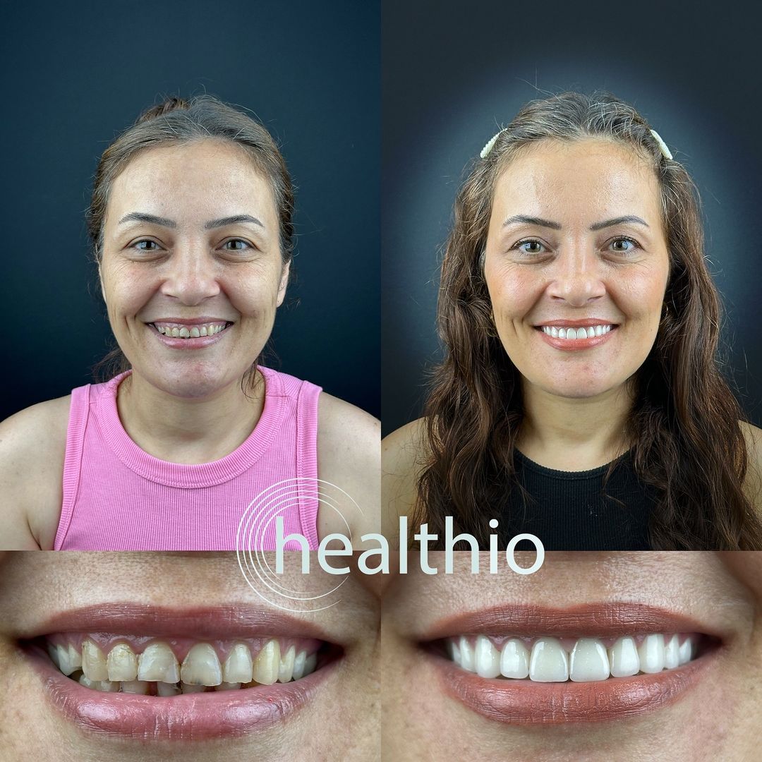 Snapinsta.app_461688798_519274184159075_6716566415852165438_n_1080