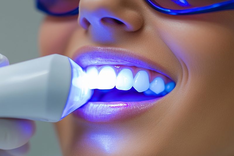 image-patient-undergoing-teeth-whitening-procedure-with-modern-whitening-system